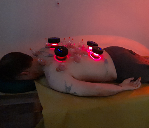 infrared cupping